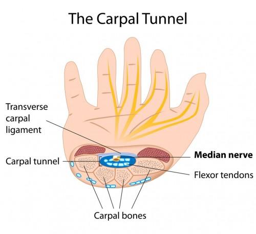 What is Carpal Tunnel Syndrome?